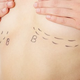 Image for article titled Plastic Surgeon Sues Over "Frankenstein Breasts" Yelp Review